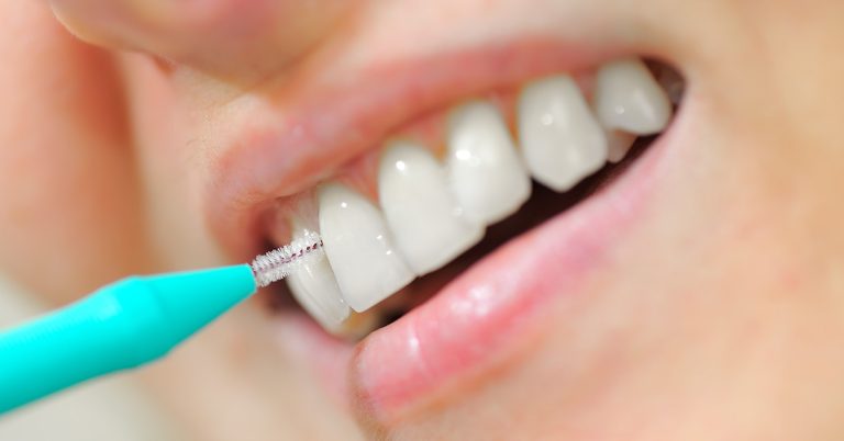 The Significance of Interdental Cleaning